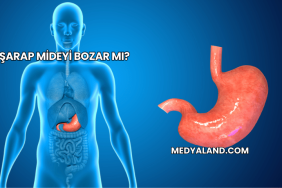 Şarap Mideyi Bozar mı?