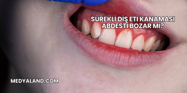 Sürekli Diş Eti Kanaması Abdesti Bozar mı?