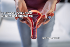 Vajinadan Gelen Beyaz Akıntı Abdesti Bozar mı?