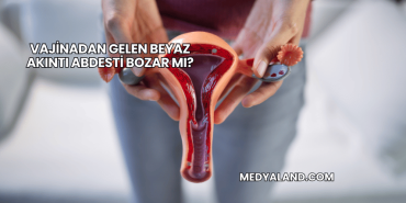 Vajinadan Gelen Beyaz Akıntı Abdesti Bozar mı?