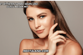 Adet Bittikten Sonra Gelen Leke Guslü Bozar mı?