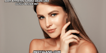 Adet Bittikten Sonra Gelen Leke Guslü Bozar mı?