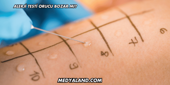 Alerji Testi Orucu Bozar mı?