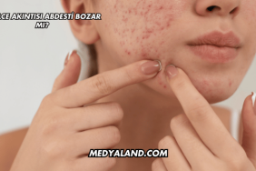 Sivilce Akıntısı Abdesti Bozar mı?