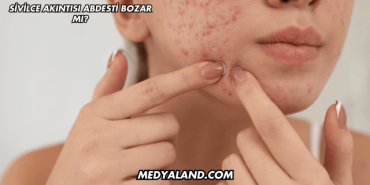 Sivilce Akıntısı Abdesti Bozar mı?