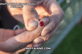 Vücuttan Kan Akması Orucu Bozar mı?