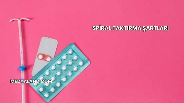 Spiral Taktırma Şartları