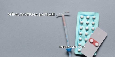 Spiral Taktırma Şartları