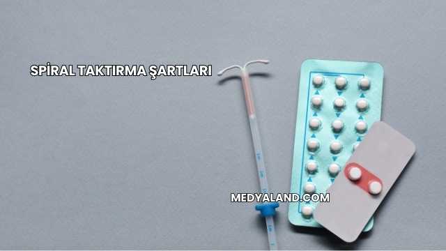 Spiral Taktırma Şartları