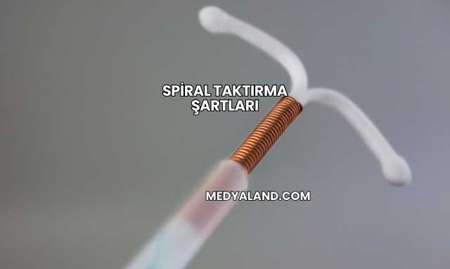 Spiral Taktırma Şartları