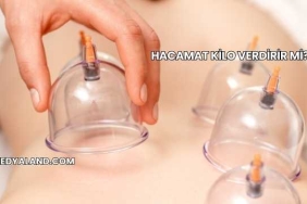 Hacamat Kilo Verdirir mi?