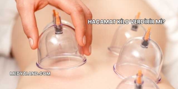 Hacamat Kilo Verdirir mi?