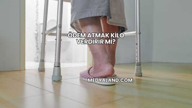 Ödem Atmak Kilo Verdirir mi?