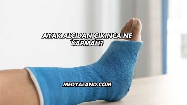 Ayak Alçıdan Çıkınca Ne Yapmalı?