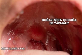 Boğazı Şişen Çocuğa Ne Yapmalı?