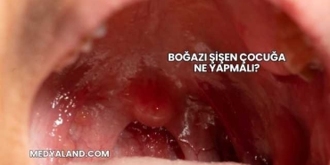 Boğazı Şişen Çocuğa Ne Yapmalı?