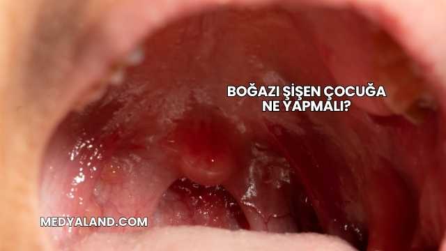 Boğazı Şişen Çocuğa Ne Yapmalı?