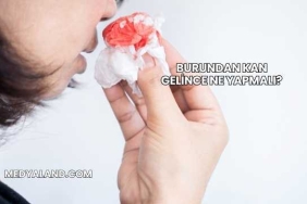 Burundan Kan Gelince Ne Yapmalı?