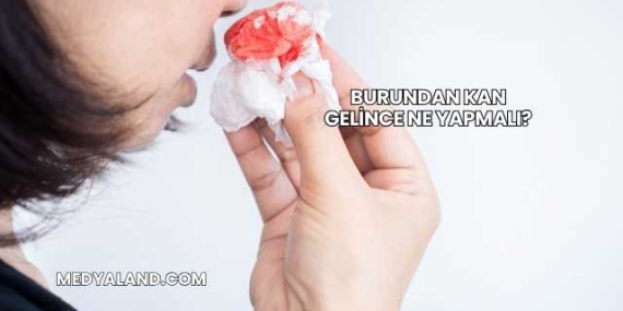 Burundan Kan Gelince Ne Yapmalı?