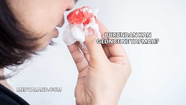 Burundan Kan Gelince Ne Yapmalı?
