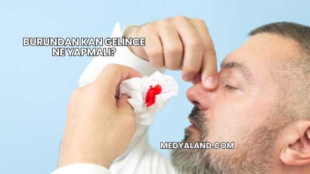 Burundan Kan Gelince Ne Yapmalı?