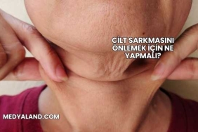 Cilt Sarkmasını Önlemek İçin Ne Yapmalı?
