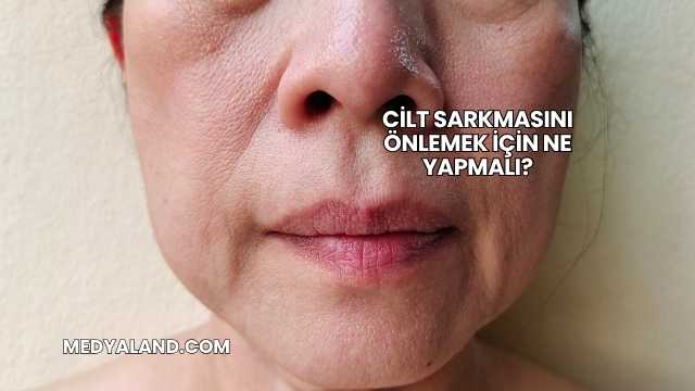 Cilt Sarkmasını Önlemek İçin Ne Yapmalı?