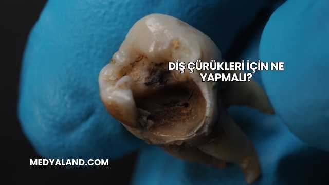 Diş Çürükleri İçin Ne Yapmalı?