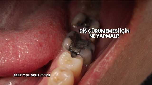 Diş Çürümemesi İçin Ne Yapmalı?