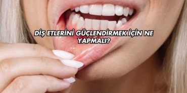 Diş Etlerini Güçlendirmek İçin Ne Yapmalı?