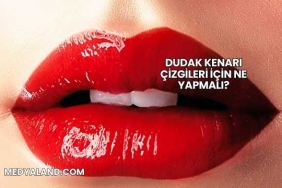 Dudak Kenarı Çizgileri İçin Ne Yapmalı?