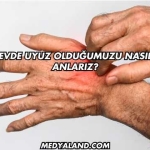 Evde Uyuz Olduğumuzu Nasıl Anlarız?