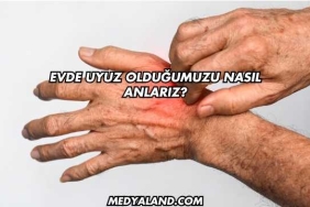 Evde Uyuz Olduğumuzu Nasıl Anlarız?