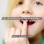 Sallanan Dişe Ne Yapmalı?