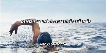 Deniz Suyu Sivilcelere İyi Gelir mi?