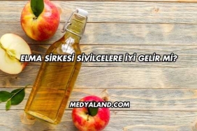Elma Sirkesi Sivilcelere İyi Gelir mi
