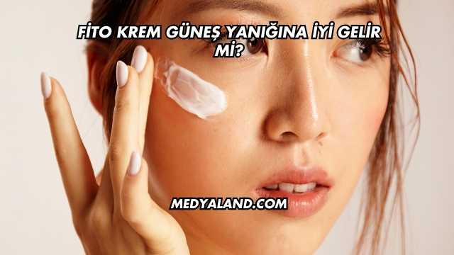 Fito Krem Güneş Yanığına İyi Gelir mi?