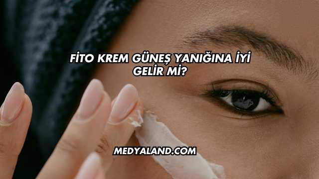 Fito Krem Güneş Yanığına İyi Gelir mi?
