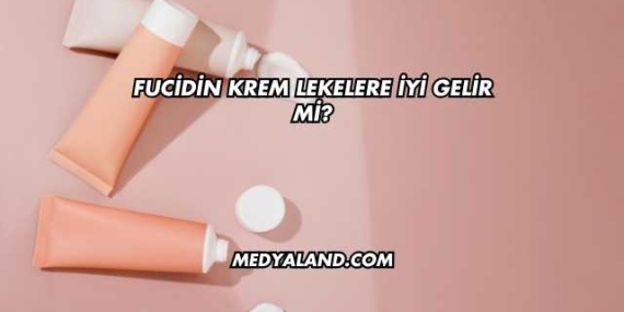 Fucidin Krem Lekelere İyi Gelir mi?