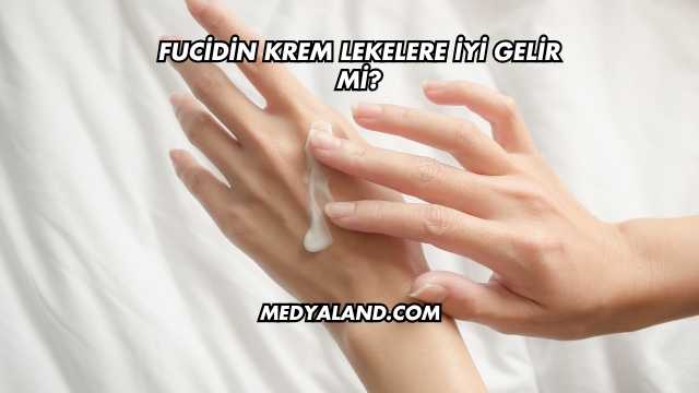 Fucidin Krem Lekelere İyi Gelir mi?