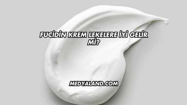 Fucidin Krem Lekelere İyi Gelir mi?