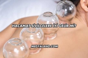 Hacamat Sivilcelere İyi Gelir mi?