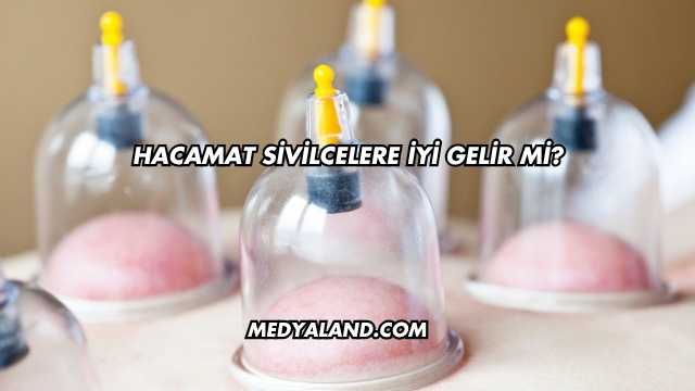 Hacamat Sivilcelere İyi Gelir mi?