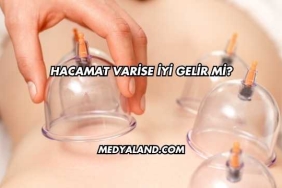 Hacamat Varise İyi Gelir mi?