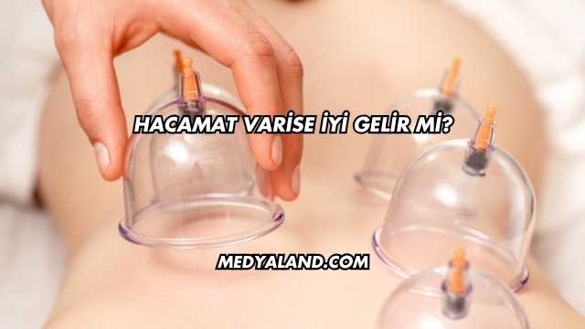 Hacamat Varise İyi Gelir mi?