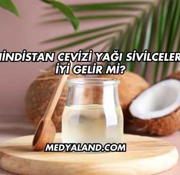 Hindistan Cevizi Yağı Sivilcelere İyi Gelir mi