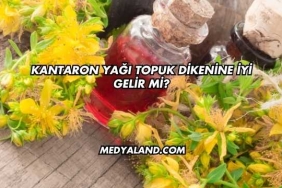 Kantaron Yağı Topuk Dikenine İyi Gelir mi?