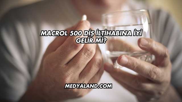 Macrol 500 Diş İltihabına İyi Gelir mi?