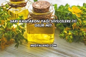 Sarı Kantaron Yağı Sivilcelere İyi Gelir mi?