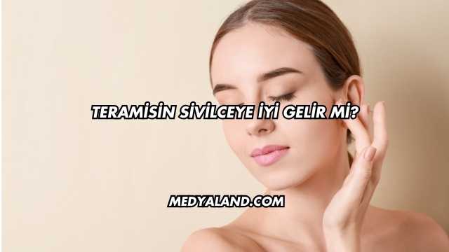 Teramisin Sivilceye İyi Gelir mi?